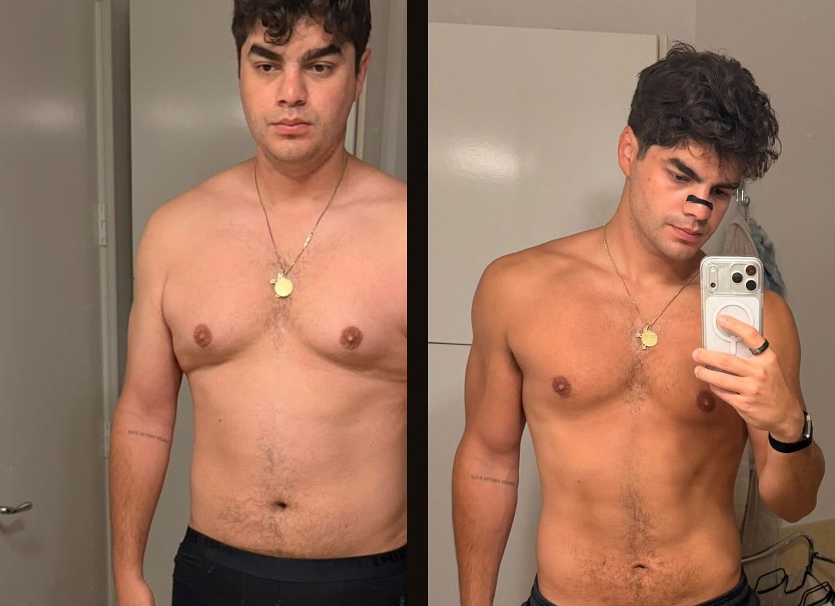 Before and after photos of Felix B., an OT member